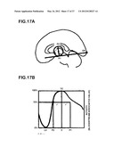 DEVICE FOR GENERATING ALTERNATIVE OF NORMAL BRAIN DATABASE diagram and image