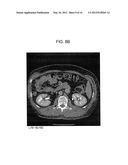 METHOD AND SYSTEM UTILIZING ITERATIVE RECONSTRUCTION WITH ADAPTIVE     PARAMETERS FOR COMPUTER TOMOGRAPHY (CT) IMAGES diagram and image