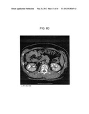 METHOD AND SYSTEM UTILIZING ITERATIVE RECONSTRUCTION WITH ADAPTIVE     PARAMETERS FOR COMPUTER TOMOGRAPHY (CT) IMAGES diagram and image