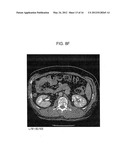 METHOD AND SYSTEM UTILIZING ITERATIVE RECONSTRUCTION WITH ADAPTIVE     PARAMETERS FOR COMPUTER TOMOGRAPHY (CT) IMAGES diagram and image