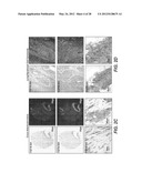 ANTI-FGF19 ANTIBODIES AND METHODS USING SAME diagram and image