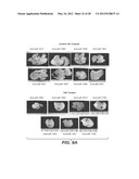 ANTI-FGF19 ANTIBODIES AND METHODS USING SAME diagram and image