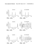 Sphingomyelin Liposomes for the Treatment of Hyperactive Bladder Disorders diagram and image