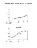 Sphingomyelin Liposomes for the Treatment of Hyperactive Bladder Disorders diagram and image