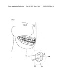 SURFACE COATING METHOD FOR AN ORTHODONTIC CORRECTIVE BRACKET diagram and image
