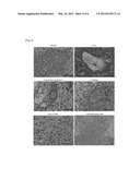 METHOD FOR SELECTING CLONE OF INDUCED PLURIPOTENT STEM CELLS diagram and image