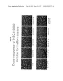 ANTIANGIOGENIC SMALL MOLECULES AND METHODS OF USE diagram and image