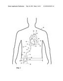 PORTABLE CONTROLLER WITH INTEGRAL POWER SOURCE FOR MECHANICAL CIRCULATION     SUPPORT SYSTEMS diagram and image