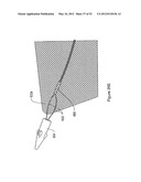 SYSTEMS, DEVICES, AND METHODS FOR TREATING PELVIC FLOOR DISORDERS diagram and image