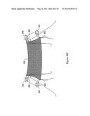 SYSTEMS, DEVICES, AND METHODS FOR TREATING PELVIC FLOOR DISORDERS diagram and image