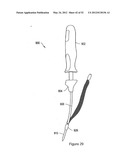 SYSTEMS, DEVICES, AND METHODS FOR TREATING PELVIC FLOOR DISORDERS diagram and image