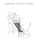 SYSTEMS, DEVICES, AND METHODS FOR TREATING PELVIC FLOOR DISORDERS diagram and image