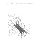 SYSTEMS, DEVICES, AND METHODS FOR TREATING PELVIC FLOOR DISORDERS diagram and image