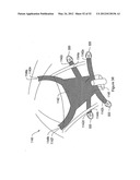 SYSTEMS, DEVICES, AND METHODS FOR TREATING PELVIC FLOOR DISORDERS diagram and image