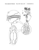 ANCHORING ASSEMBLIES FOR ENDOSCOPES diagram and image