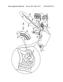 ANCHORING ASSEMBLIES FOR ENDOSCOPES diagram and image