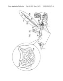 ANCHORING ASSEMBLIES FOR ENDOSCOPES diagram and image