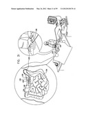 ANCHORING ASSEMBLIES FOR ENDOSCOPES diagram and image