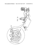 ANCHORING ASSEMBLIES FOR ENDOSCOPES diagram and image