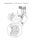 ANCHORING ASSEMBLIES FOR ENDOSCOPES diagram and image