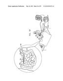 ANCHORING ASSEMBLIES FOR ENDOSCOPES diagram and image