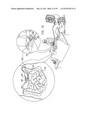 ANCHORING ASSEMBLIES FOR ENDOSCOPES diagram and image