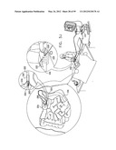 ANCHORING ASSEMBLIES FOR ENDOSCOPES diagram and image