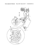 ANCHORING ASSEMBLIES FOR ENDOSCOPES diagram and image