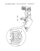 ANCHORING ASSEMBLIES FOR ENDOSCOPES diagram and image