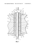 SEAL ANCHOR FOR USE IN SURGICAL PROCEDURES diagram and image