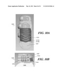 MODULAR ANTENNA FOR IMPLANTABLE MEDICAL DEVICE diagram and image