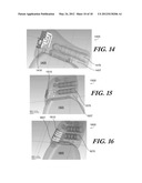 MODULAR ANTENNA FOR IMPLANTABLE MEDICAL DEVICE diagram and image