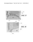 MODULAR ANTENNA FOR IMPLANTABLE MEDICAL DEVICE diagram and image