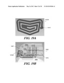 MODULAR ANTENNA FOR IMPLANTABLE MEDICAL DEVICE diagram and image