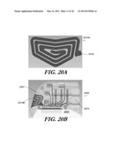 MODULAR ANTENNA FOR IMPLANTABLE MEDICAL DEVICE diagram and image