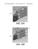 MODULAR ANTENNA FOR IMPLANTABLE MEDICAL DEVICE diagram and image