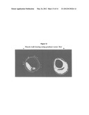 Automated methods and systems for vascular plaque detection and analysis diagram and image