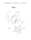 Non-Invasive Measurement Of Fluid Pressure In An Adjustable Gastric Band diagram and image