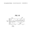 Non-Invasive Measurement Of Fluid Pressure In An Adjustable Gastric Band diagram and image