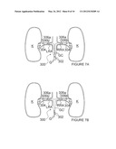 METHODS FOR RENAL NEUROMODULATION diagram and image