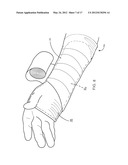 MOLDABLE INJURY THERAPY DEVICE AND METHOD diagram and image