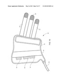 MOLDABLE INJURY THERAPY DEVICE AND METHOD diagram and image