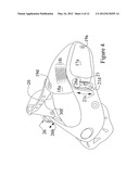 Universally adjustable cervical collar diagram and image