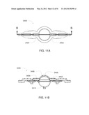 Systems, Devices and Methods for Cardiopulmonary Treatment and Procedures diagram and image