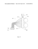 Systems, Devices and Methods for Cardiopulmonary Treatment and Procedures diagram and image