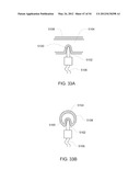 Systems, Devices and Methods for Cardiopulmonary Treatment and Procedures diagram and image