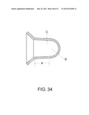 Systems, Devices and Methods for Cardiopulmonary Treatment and Procedures diagram and image