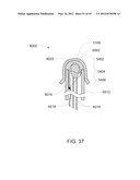 Systems, Devices and Methods for Cardiopulmonary Treatment and Procedures diagram and image