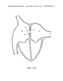 INTRA-ATRIAL IMPLANTS TO DIRECTIONALLY SHUNT BLOOD diagram and image