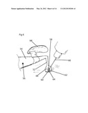 Tissue Desensitization Instrument & Method diagram and image